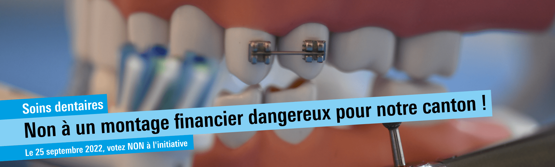FDP - PLR Slider